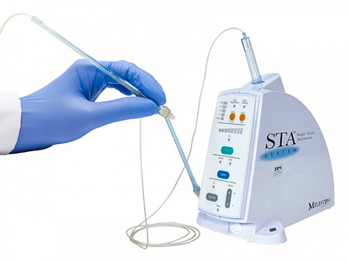 Компьютеризированная анестезия STA